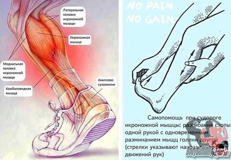 Причины возникновения судорог и методы их устранения